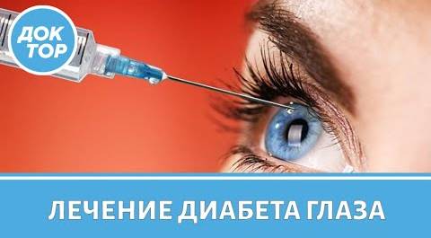 Как избежать диабета глаза. Лечение диабетической ретинопатии