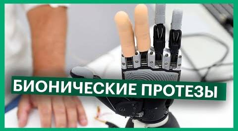 Руки-роботы: Как устроены бионические протезы?